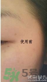 dr.jart适合什么年龄层？蒂佳婷适合年龄