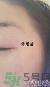 dr.jart适合什么年龄层？蒂佳婷适合年龄