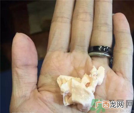 奥伦纳素冰白面膜好用吗?奥伦纳素冰白面膜测评