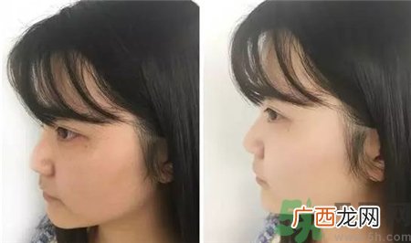 倩碧双星淡斑精华怎么样?倩碧淡斑精华效果怎么样?