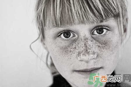 脸上长雀斑吃什么好？有雀斑不能吃什么？
