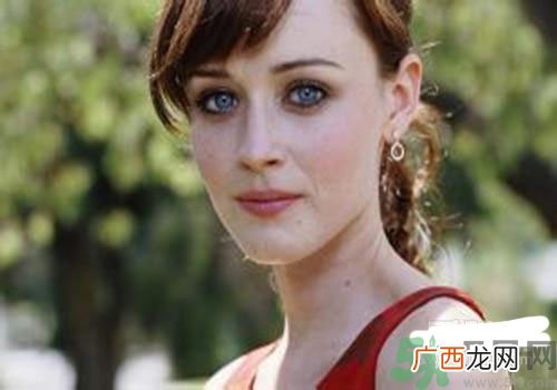 雀斑和黄褐斑的区别 雀斑和黄褐斑有什么不一样？