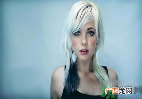 雀斑和黄褐斑的区别 雀斑和黄褐斑有什么不一样？