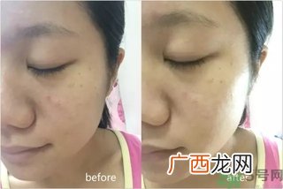 rilastil面膜使用方法 维纳斯蒂尔面膜怎么用？