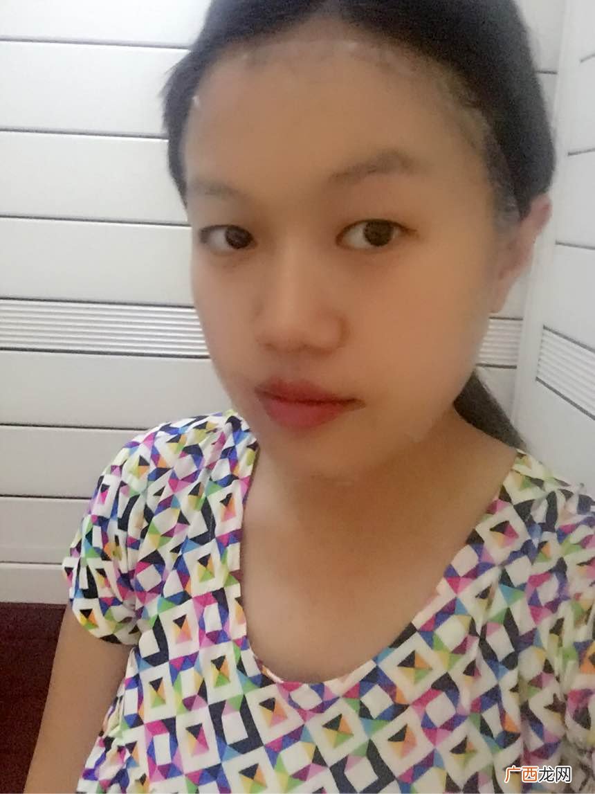 美即水光盈玫瑰面膜多少钱?美即水光盈玫瑰面膜价格