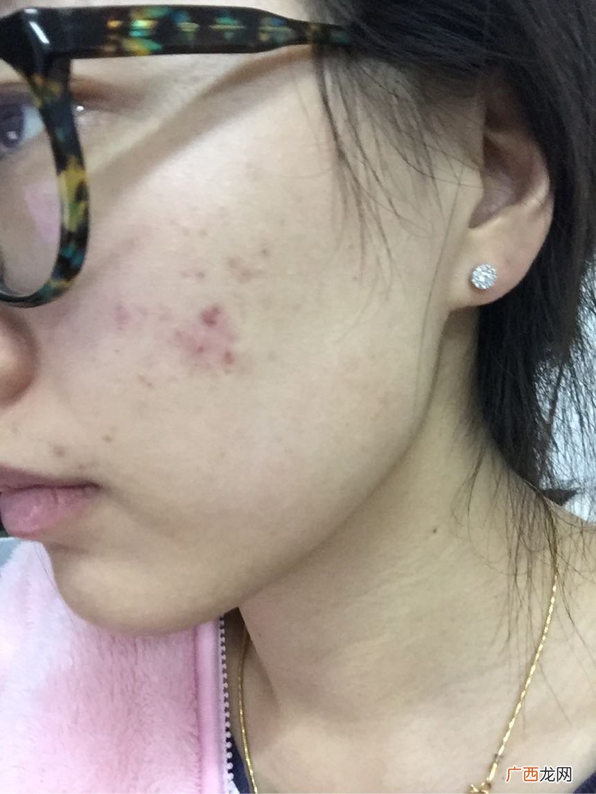 达尔肤dr.wu杏仁酸怎么样?达尔肤dr.wu杏仁酸好用吗?