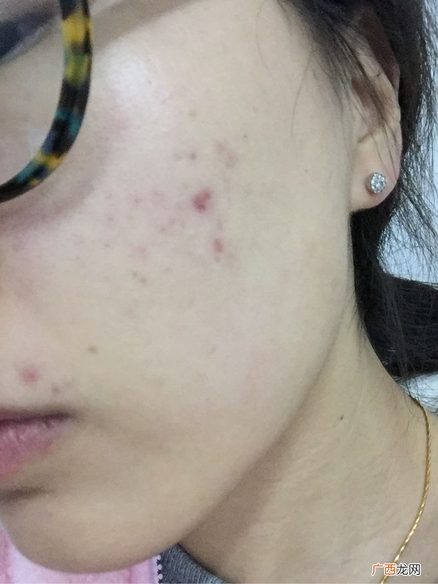 达尔肤dr.wu杏仁酸怎么样?达尔肤dr.wu杏仁酸好用吗?