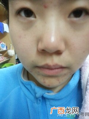 石泽研究所毛孔抚子小苏打洁肤皂怎么样?好用吗?