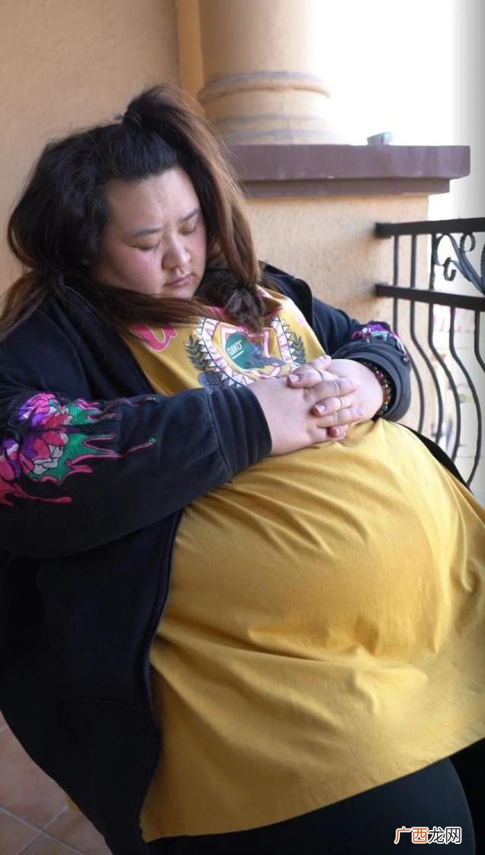 杨天真切胃，29岁女大学生被杨天真安利切胃手术