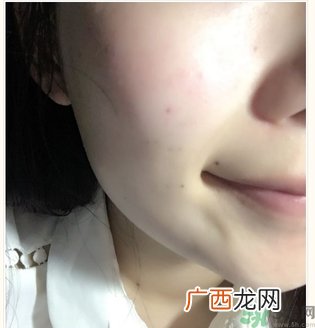 丽得姿面膜适合孕妇可以用吗？丽得姿面膜哪些孕妇可以用？