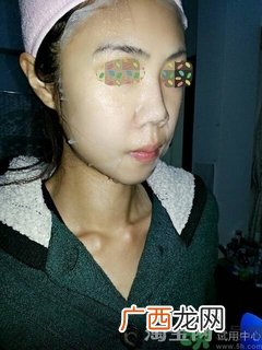 可莱丝针剂水库面膜用完要洗脸吗?