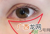 如何快速消除眼袋?快速消除眼袋的小窍门