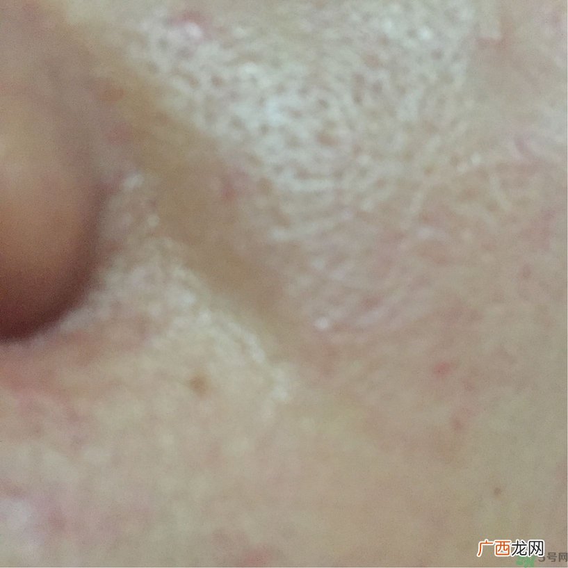 美即水光盈金缕梅面膜多少钱?美即水光盈金缕梅面膜价格