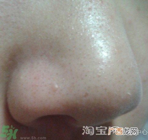 holika猪鼻贴多少钱?holika猪鼻贴韩国价格