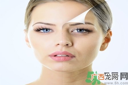 吃什么可以美白？美白小窍门有哪些？