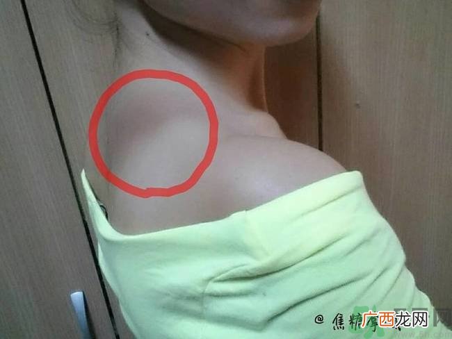 安耐晒喷雾和乳液哪个好？安耐晒喷雾和乳液区别