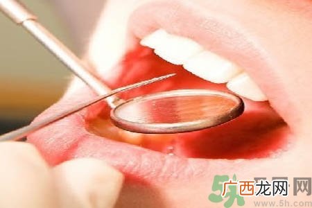 冷光美白牙齿是什么？冷光美白牙齿的好处有哪些？
