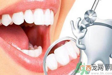 冷光美白牙齿是什么？冷光美白牙齿的好处有哪些？