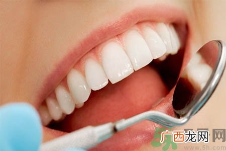冷光美白牙齿的价格是多少？做冷光美白牙齿需要多少钱？