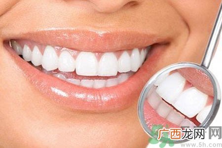 冷光美白牙齿可以保持多长时间？冷光美白牙齿有副作用吗？