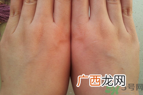 欧缇丽皇后水孕妇可以用吗?欧缇丽皇后水孕妇能用吗?
