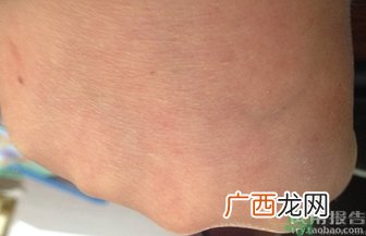 安耐晒防晒霜用完要洗脸吗?安耐晒防晒霜的功效与作用