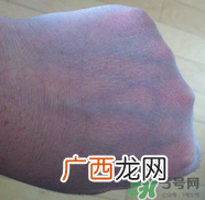 安耐晒防晒霜孕妇可以用吗?安耐晒防晒霜孕妇能用吗?