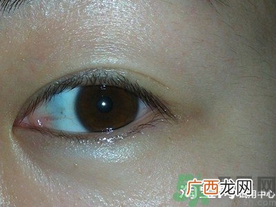 珍视明眼贴怎么用?珍视明眼贴使用方法