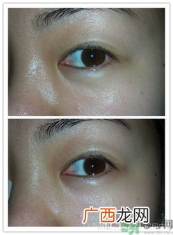 珍视明眼贴怎么用?珍视明眼贴使用方法