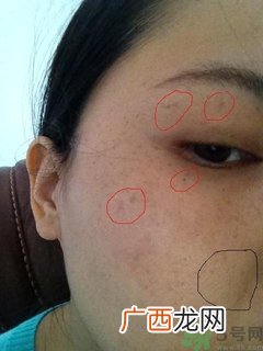 pola美白丸怎么样?pola美白丸有用吗?