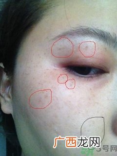 pola美白丸怎么样?pola美白丸有用吗?