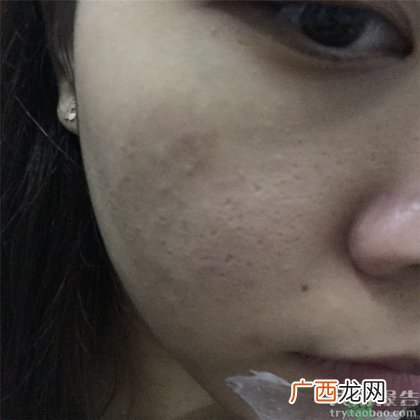 菲洛嘉十全大补面膜怎么用?菲洛嘉十全大补面膜使用方法