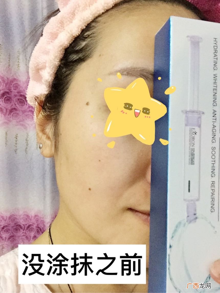 eaoron水光针怎么用?eaoron水光针使用方法