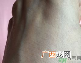 eaoron水光针多少钱几毫升?澳洲eaoron水光针价格