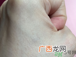eaoron水光针多少钱几毫升?澳洲eaoron水光针价格