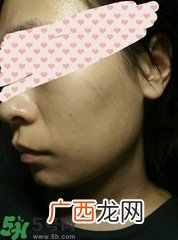 蔻诗弥黑面膜怎么样?蔻诗弥黑面膜好用吗?