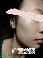 蔻诗弥黑面膜怎么样?蔻诗弥黑面膜好用吗?