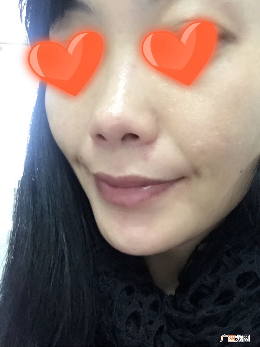 新西兰皇家蜂毒面膜怎么样?新西兰皇家蜂毒面膜好用吗?