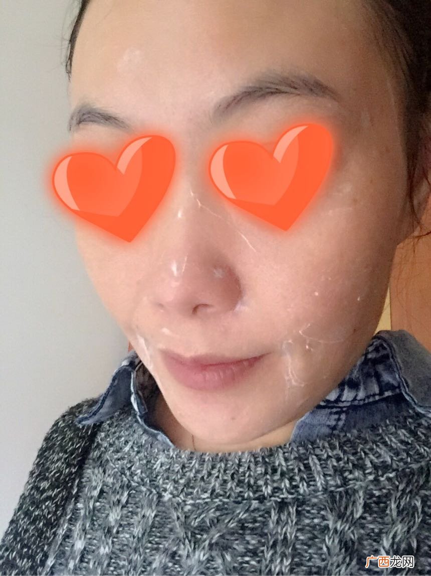新西兰皇家蜂毒面膜怎么样?新西兰皇家蜂毒面膜好用吗?