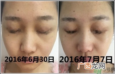 pola美白丸怎么吃效果最好?pola美白丸怎么服用?