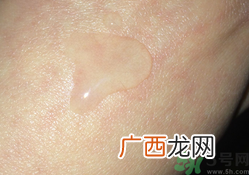 法兰琳卡玫瑰花苞水怎么用?法兰琳卡玫瑰花苞水使用方法