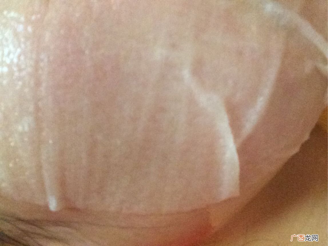 高丽雅娜肉毒面膜用完要洗脸吗?高丽雅娜肉毒面膜的功效与作用