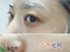 蒂佳婷蓝色药丸面膜使用心得 dr.jart+蓝色药丸面膜使用感受