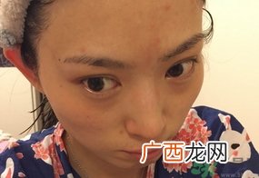 雪肌精面膜多少钱一瓶?日本雪肌精面膜价