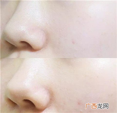 春雨面膜的功效与作用 春雨面膜有什么效果