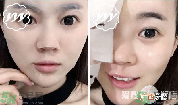 forencos七天换肤面膜效果怎么样