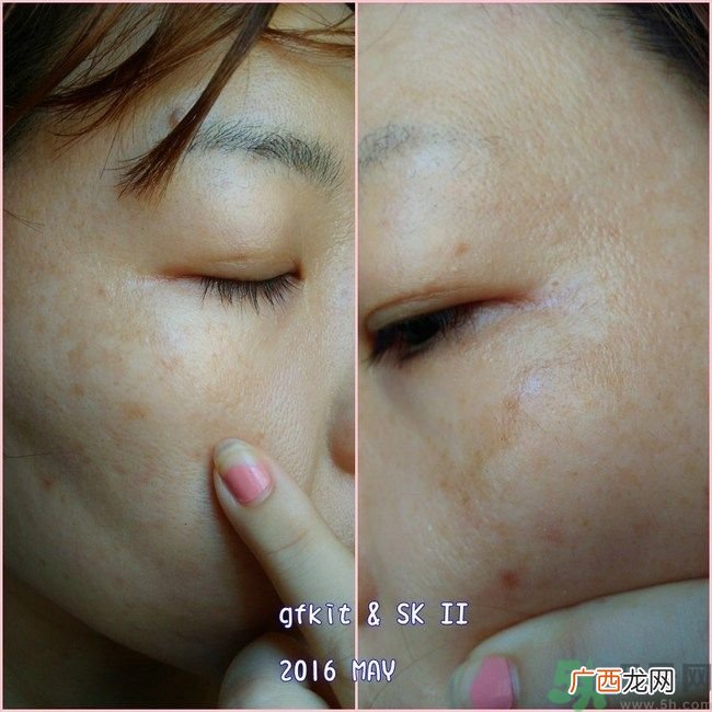 sk2祛斑精华怎么样？skii祛斑精华使用方法