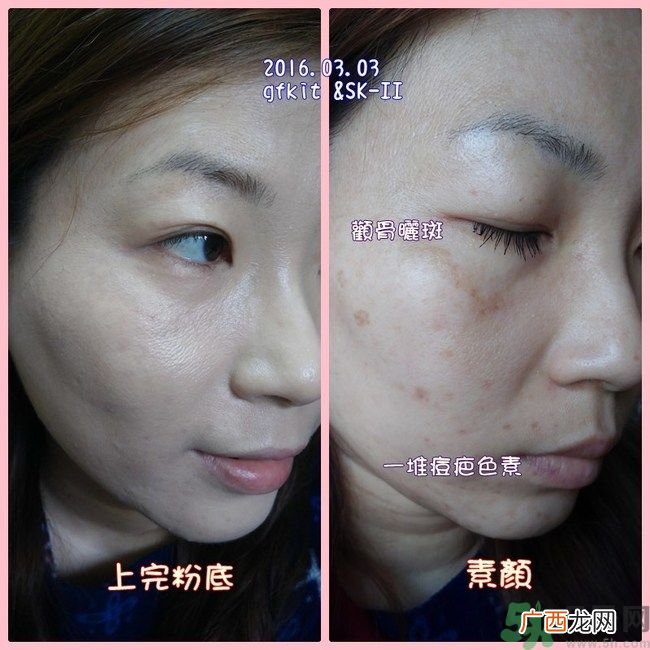 sk2祛斑精华怎么样？skii祛斑精华使用方法
