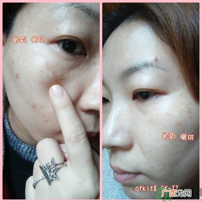 sk2祛斑精华怎么样？skii祛斑精华使用方法