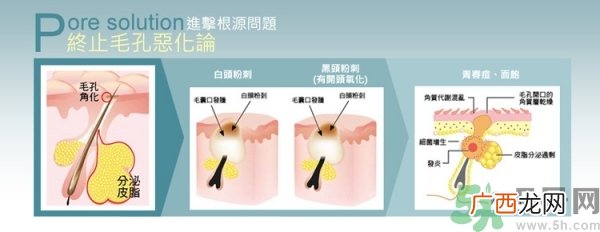 霓净思Neogence粉刺溶解精华液真假辨别图